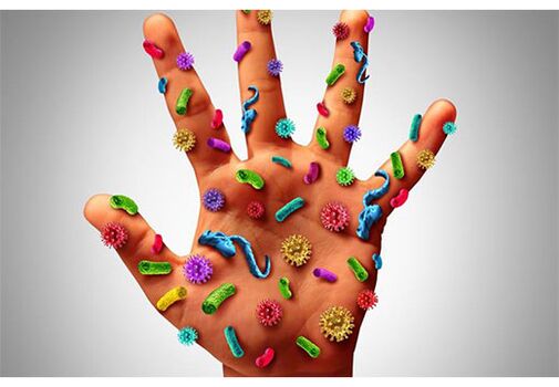 Foci of human papillomavirus are located on the hands